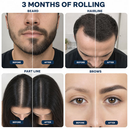 WexoHair Growth Roll on Serum